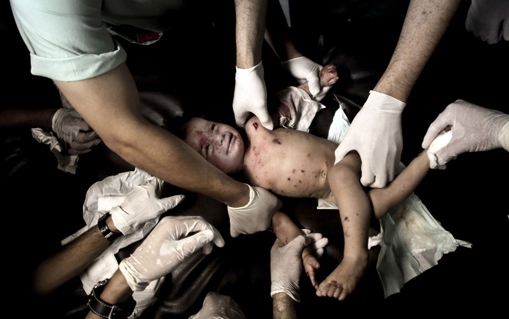 Palestinian medical personnel treat a wounded girl at the emergency room of the Shifa hospital in Gaza City on July 18, 2014. © (AP Photo/Khalil Hamra)